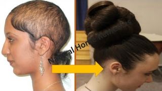 ⭐AWARDED BEST HAIR GROWTH REMEDY TO GROW HAIR IN 4 WEEKS || FIX HAIR FALL || Natural Home Remedies